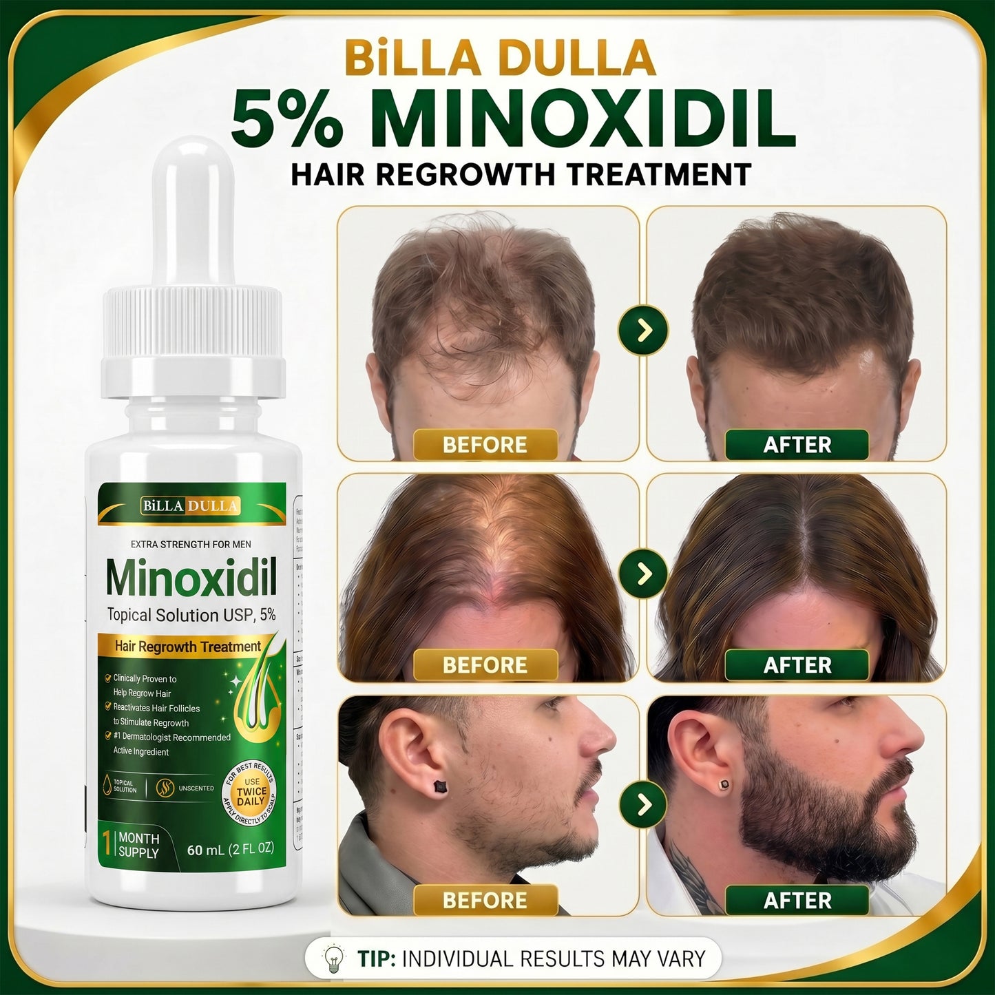 5% Minoxidil Hair Growth Treatment for Men - Extra Strength Topical Solution USP 5 Percent for Hair Loss, Hair Regrowth, Thinning Hair & Receding Hairline - Fast Hair Growth Serum with Dropper Applicator for Beard Growth & Fuller Thick Hair, 3 x 60mL