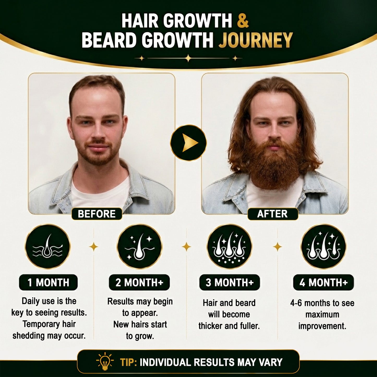 5% Minoxidil Hair Growth Treatment for Men - Extra Strength Topical Solution USP 5 Percent for Hair Loss, Hair Regrowth, Thinning Hair & Receding Hairline - Fast Hair Growth Serum with Dropper Applicator for Beard Growth & Fuller Thick Hair, 3 x 60mL